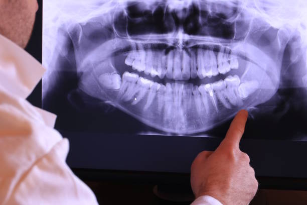 Best Emergency Denture Repair in East Northport, NY
